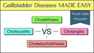 Cholecystitis vs Cholelithiasis vs Cholangitis vs Choledocholithiasis Nursing USMLE [upl. by Amlez116]