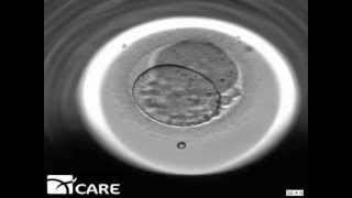 Time Lapse Embryo Imaging [upl. by Isidro]