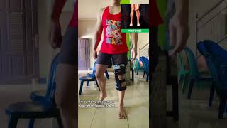 Knee Brace untuk Kaki XO [upl. by Warder617]