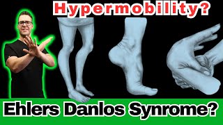 Ehlers Danlos Syndrome Hypermobility Symptoms Diagnosis amp Test [upl. by Gurl170]