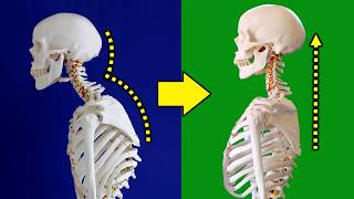 FIX Your Forward Head Posture in 5 Minutes a Day [upl. by Louise]