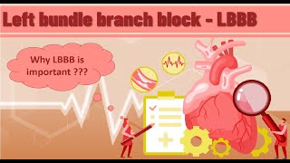 left bundle bundle branch block LBBB  ECG findings clinical significance 4 ECG examples [upl. by Yelrehs217]