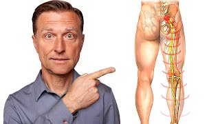 Say Goodbye to Sciatica Nerve Pain in 5 Minutes [upl. by Inaffyt264]