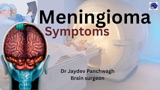 Meningioma The Brain Tumor You Might Have And Not Even Know It [upl. by Nnailuj]