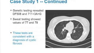 Management Strategies for Adults with Cystic Fibrosis [upl. by Gudrin]