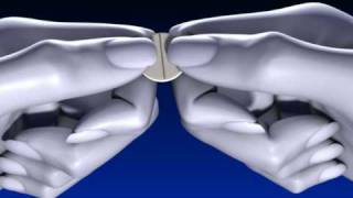 Tabletten richtig teilen  Einfache schmale Bruchkerbe [upl. by Tome]