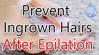 How to Prevent Ingrown Hairs After Epilation [upl. by Thomasina]