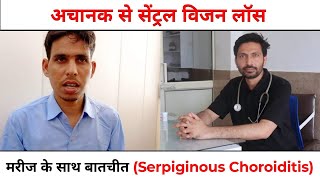 Serpiginous Choroiditis White Dot Syndrome अचानक से आंख की रोशनी चले जाना Loss of Central vision [upl. by Akeinahs]