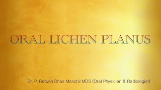 Diagnosis of Oral Lichen Planus [upl. by Kevina855]