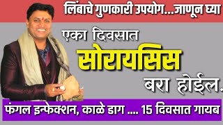 सर दर्द का सटीक इलाज इस पॉइंट को दबाएं दिन मे 2 बार [upl. by Siram983]