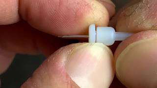 Dental Intraosseous Anesthesia Xtip [upl. by Taveda]