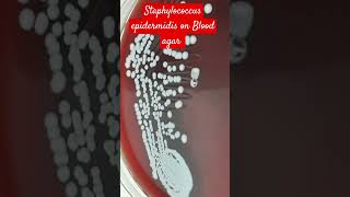 Staphylococcus epidermidis Colony Morphology on Blood Agar [upl. by Boak]