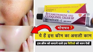 Betnovate C Cream Reviews Uses Benefits amp Side effects  ये है इस क्रीम का असली काम [upl. by Ettegdirb]