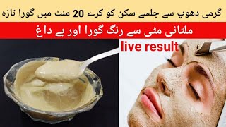 Multani Mitti Face Pack for Wrinkles and Pigmentation  Multani Mitti Se Rang Gora Karne Ka Tarika [upl. by Jenni180]