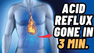 How To Stop Acid Reflux Fast  Acid Reflux Home Remedy  Heartburn Remedies [upl. by Accem]