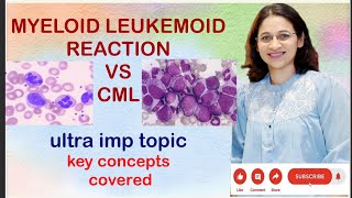 LEUKEMIACML vs LEUKEMOID REACTION VIMP topic for ugpg neetpg inicet pathologyconcepts [upl. by Nhguaved]