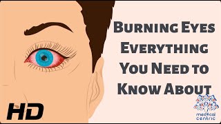 Burning Eyes Everything You Need to Know [upl. by Eked619]