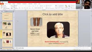 Agni 21 Easy way for diagnosis in clinic  Dr Sajeev malayalam webinar [upl. by Aiahc]