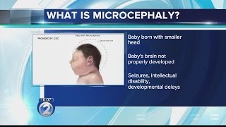 What is microcephaly [upl. by Agnese585]