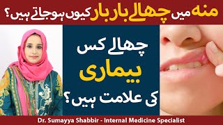 Moun Main Chalon Ka Ilaj  Munh Mein Chhale Kyon Hote Hain  Mouth Ulcer Treatment In Urdu [upl. by Hershell760]