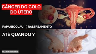 CÂNCER COLO UTERINO Papanicolau Rastreamento até quando Histerectomia  A63 [upl. by Hayn340]