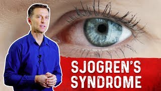 What is Sjogrens Syndrome Understanding Sjogrens Syndrome Symptoms – Dr Berg [upl. by Arama]