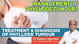 Management of Phyllode Tumour Treatment and Diagnosis of Phyllode Tumour [upl. by Hareemas]