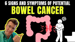 6 SIGNS AND SYMPTOMS OF BOWEL CANCER [upl. by Eleen]