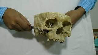 Base of the Skull Anatomical position demonstrated by Dr Zobayer Mahmud Khan [upl. by Godiva]