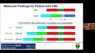 Yale Cancer Center Grand RoundsSturges Lecture in Hematology  June 7 2024 [upl. by Gaile]