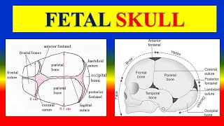 FETAL SKULL  Bones Regions Landmarks amp sutures fontanelles diameters amp Moulding  OBG [upl. by Koetke]