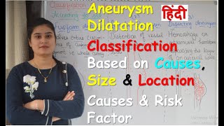 Aneurysm Dilatation in Hindi  Classification Based on Cause Size amp Location  Causes amp Risk Factor [upl. by Sharona864]