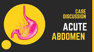 Case Discussion  Acute Abdomen [upl. by Aneleiram]