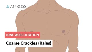 Coarse Crackles Rales  Lung Auscultation  Episode 3 [upl. by Nodarb]