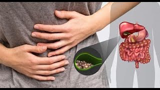 What i learnt about gallstones disease [upl. by Yorgo]