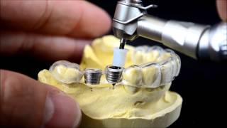 Dental implant surgical guide drilling protocol [upl. by Atinhoj]