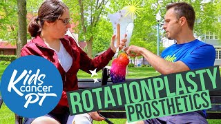 All About Rotationplasty Prosthetics [upl. by Ban]