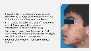 Lecture149 Perforating Dermatoses Rooks Chapter 96 [upl. by Geof3]