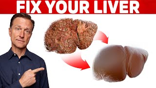 The 6 Best Ways to Heal a Fatty Liver [upl. by Philemol]