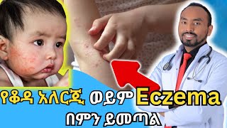 የቆዳ አለርጂ ወይም Eczema በምን ይመጣል  What causes skin allergy or eczema  Dr Fasil [upl. by Durr252]