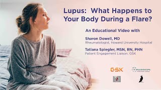 Lupus What Happens to Your Body During a Lupus Flare [upl. by Katya]