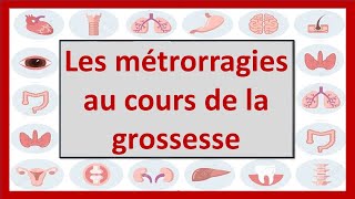 🔴HÉMORRAGIES GÉNITALES AU COURS DE LA GROSSESSE  hematome retroplacentaire  placenta previa [upl. by Ittap]