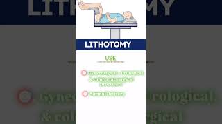 Patient positioning nursing video Important position for patients and use🎯 nursingofficerexam [upl. by Ahsakal279]