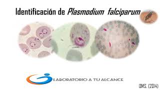 Identifica Plasmodium falciparum En 3 minutos [upl. by Azzil966]