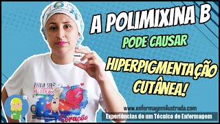 A Polimixina B e a Hiperpigmentação Cutânea [upl. by Ytsirhk581]