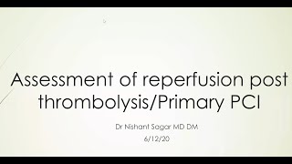 Assessment of reperfusion post fibrinolysisPrimary PCI [upl. by Aivital]