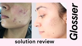 Glossier Solution Review [upl. by Htederem278]