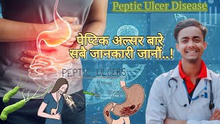 Peptic ulcerके हो त पेप्टिक अल्सरसबै जानकारी जानौं SignampSymptomsInvestigationTreatment in nepali [upl. by Aicenert]