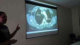 ATENUACIÓN Y ESCALA DE HOUNSFIELD EN TOMOGRAFIA COMPUTARIZADA ☢️ LIVE DESDE EL AULA [upl. by Monique849]