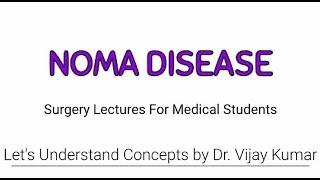 Noma Disease  Cancrum Oris  Gangrenous Stomatitis  Surgery Lectures [upl. by Nordin641]